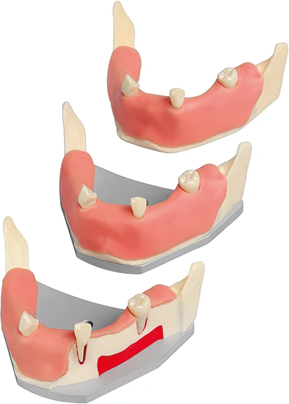Stück Stück