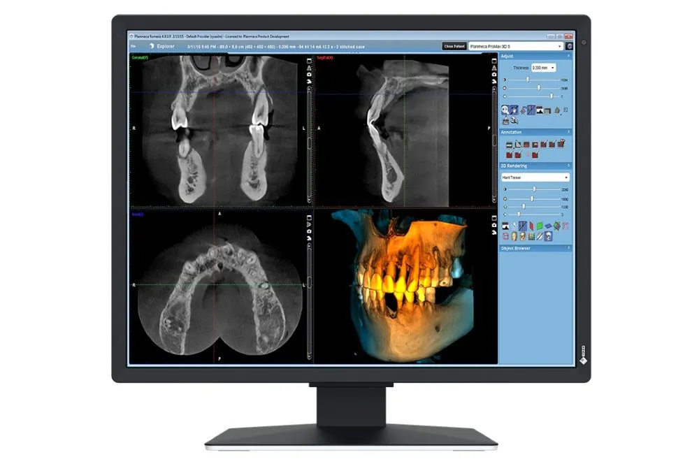  2 MP-Medizin-Monitor für die 2D-Befundung im Befundungsraum (RK 5) 
