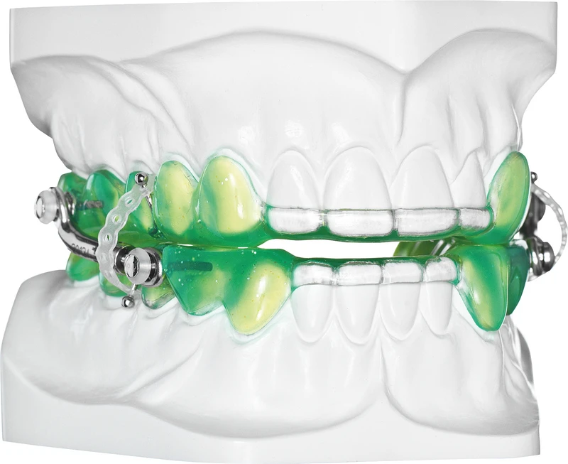 Flasche 100 ml neongrün