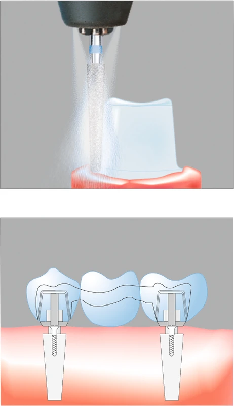 Packung 3 Stück blau standard, FGXL, Figur 137, 8 mm, 0°, ISO 010