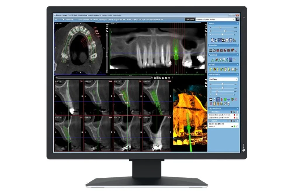  2 MP-Medizin-Monitor für die 2D-Befundung im Behandlungsraum (RK 6) 