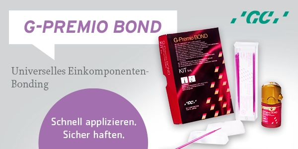 GC G-Premio BOND - universelles Einkomponenten-Bonding GC G-Premio BOND
