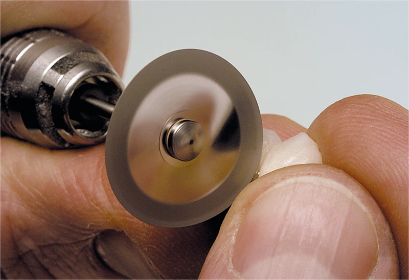 Stück beidseitig, Ø 22 mm, S: 0,15 mm Stück beidseitig, Ø 22 mm, S: 0,15 mm
