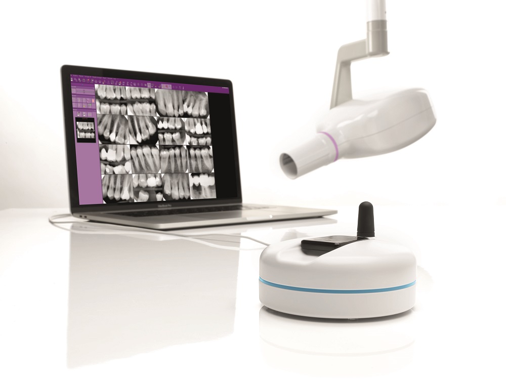  Kabelloser DC-Intraoralsensor inkl. Zubehör 